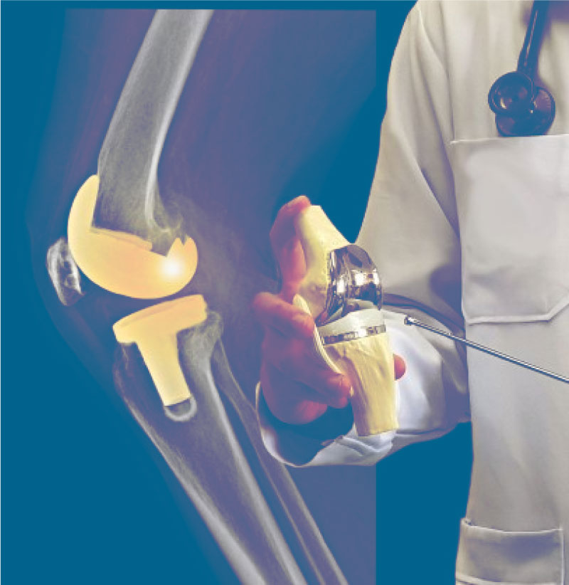 Prótesis de rodilla y hombro en Guayaquil